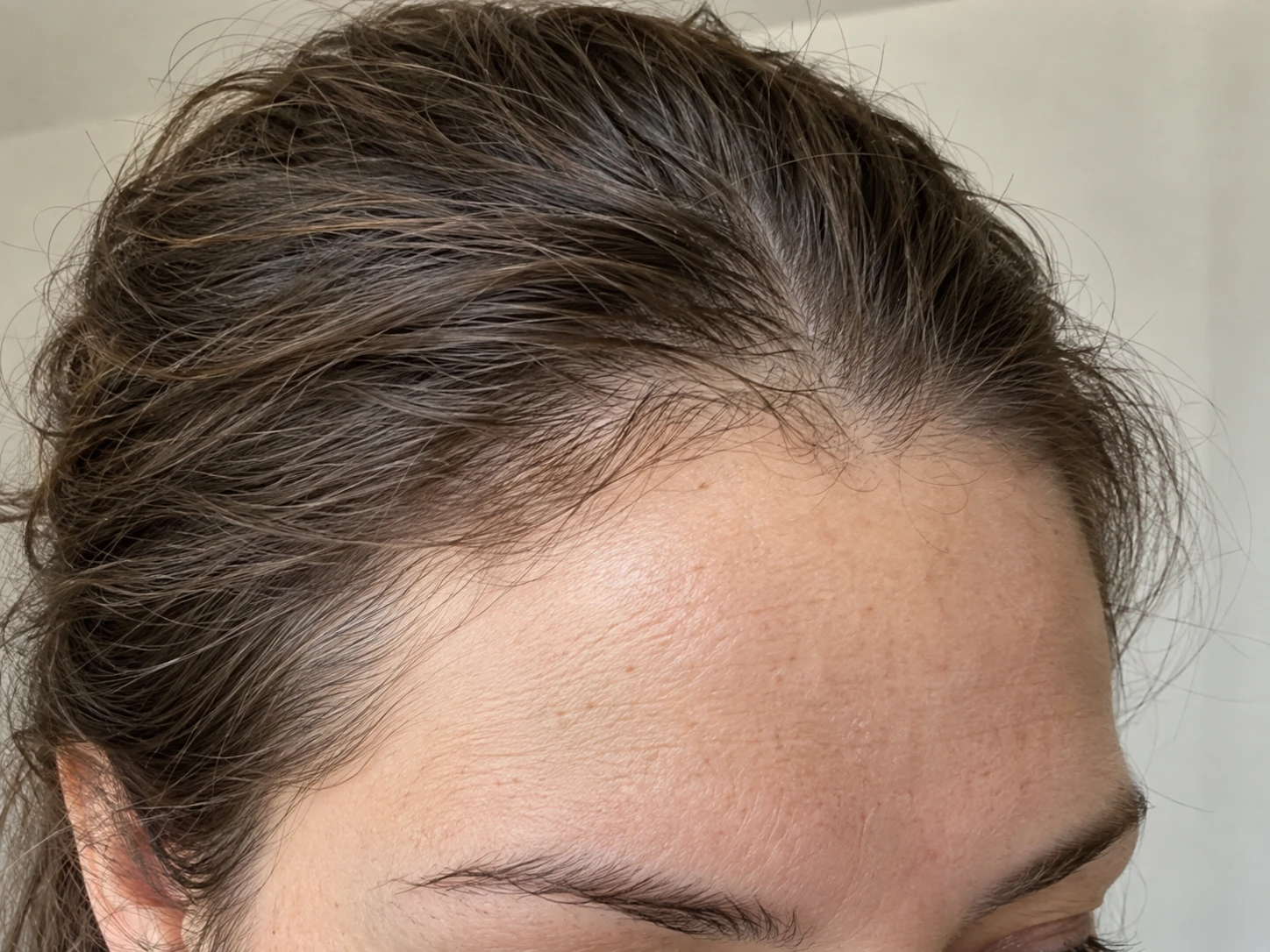 A hairline and temple in natural light